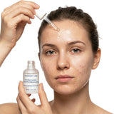 10% Niacinamide +1% Zinc PCA Balancing Serum